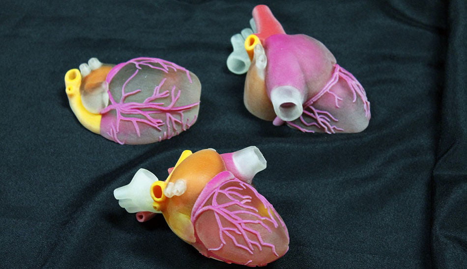 3d printed heart